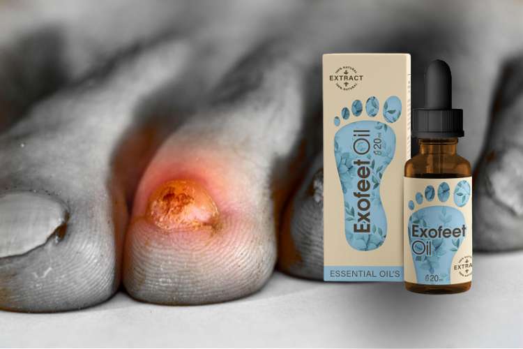 Exofeet Oil мнения форум бг мама